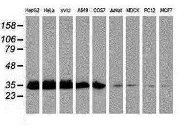 Western Blot: Exosome component 7 Antibody (OTI1G8) [NBP2-01732]