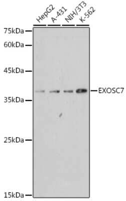 Western Blot: Exosome component 7 Antibody (6E5N8) [NBP3-15270]