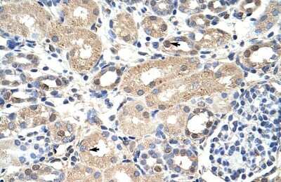 最新人気 7 component Exosome Antibody by (NBP1-57199) Free BSA - ヴァイスシュヴァルツ