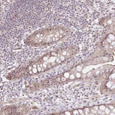 Immunohistochemistry-Paraffin: Exosome component 7 Antibody [NBP1-84933]