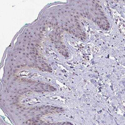 Immunohistochemistry-Paraffin: Exosome component 7 Antibody [NBP2-38837]