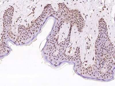 Immunohistochemistry-Paraffin: Exosome component 7 Antibody [NBP2-97525]