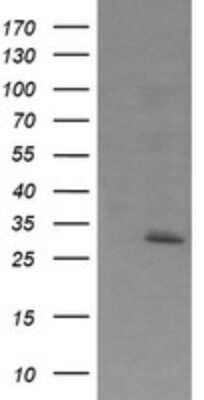 Western Blot: Exosome component 7 Antibody (OTI1E8)Azide and BSA Free [NBP2-71720]