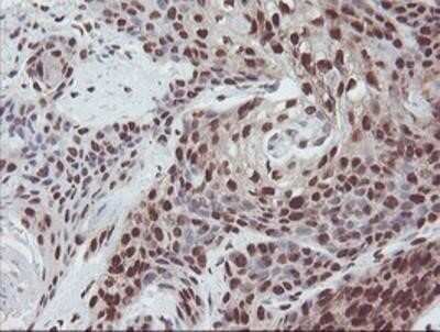 Immunohistochemistry: Exosome component 7 Antibody (OTI1G8) - Azide and BSA Free [NBP2-71722]