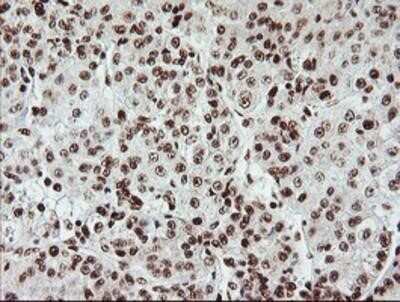 Immunohistochemistry: Exosome component 7 Antibody (OTI1G8) - Azide and BSA Free [NBP2-71722]