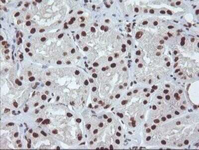Immunohistochemistry: Exosome component 7 Antibody (OTI1G8) - Azide and BSA Free [NBP2-71722]