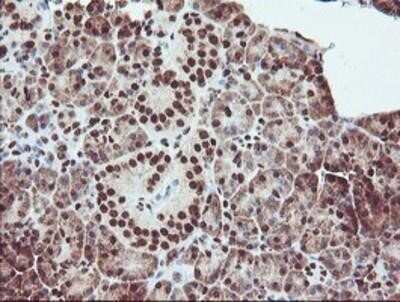 Immunohistochemistry: Exosome component 7 Antibody (OTI1G8) - Azide and BSA Free [NBP2-71722]