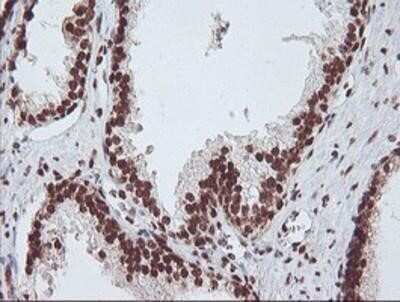 Immunohistochemistry: Exosome component 7 Antibody (OTI1G8) - Azide and BSA Free [NBP2-71722]