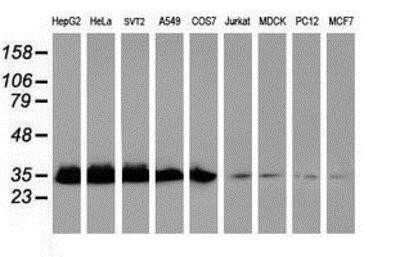 Western Blot: Exosome component 7 Antibody (OTI1G8)Azide and BSA Free [NBP2-71722]