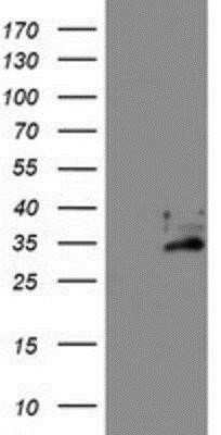 Western Blot: Exosome component 7 Antibody (OTI1G8)Azide and BSA Free [NBP2-71722]