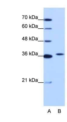 Western Blot: Exosome component 7 Antibody [NBP1-57199]