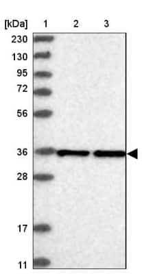Western Blot: Exosome component 7 Antibody [NBP1-84933]