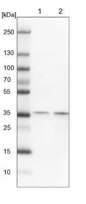 Western Blot: Exosome component 7 Antibody [NBP1-84933]