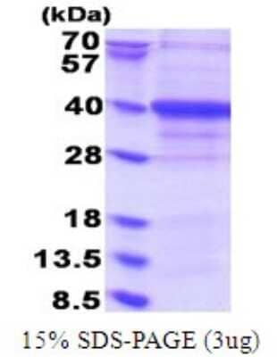 SDS-PAGE: Recombinant Human Exosome component 7 His Protein [NBP2-51766]