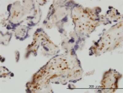 Immunohistochemistry-Paraffin: Exosome component 8 Antibody (1G5) [H00011340-M01]