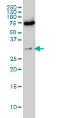 Western Blot: Exosome component 8 Antibody (1G5) [H00011340-M01]