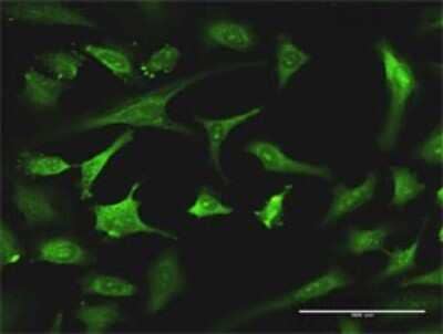 Immunocytochemistry/ Immunofluorescence: Exosome component 8 Antibody (4B3) [H00011340-M02]