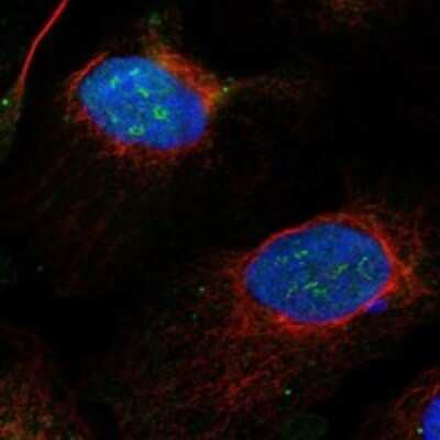 Immunocytochemistry/ Immunofluorescence: Exosome component 8 Antibody [NBP3-17842]