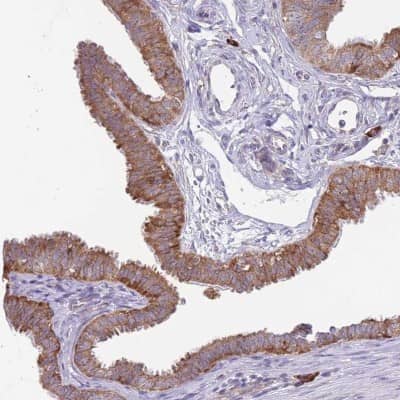 Immunohistochemistry-Paraffin: Exosome component 8 Antibody [NBP2-47466]