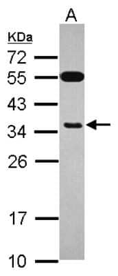 Western Blot: Exosome component 8 Antibody [NBP2-14953]