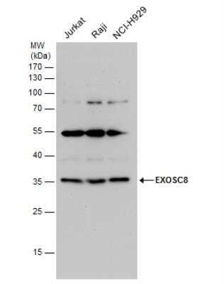 Western Blot: Exosome component 8 Antibody [NBP2-14953]