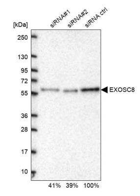 Western Blot: Exosome component 8 Antibody [NBP2-47465]