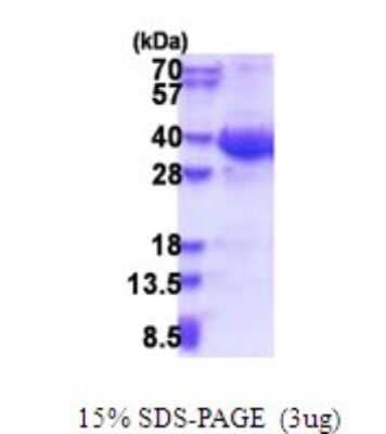 SDS-PAGE: Recombinant Human Exosome component 8 His Protein [NBP2-51642]