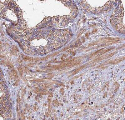 Immunohistochemistry-Paraffin: Exostosin 1 Antibody [NBP1-91875]