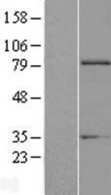 Western Blot: Exostosin 1 Overexpression Lysate [NBL1-10391]