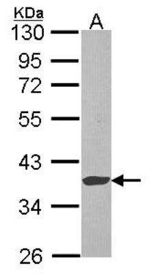 Western Blot: Exostosin-like 2/EXTL2 Antibody [NBP2-16394]