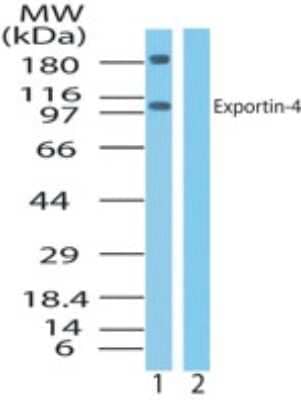 Western Blot: Exportin 4 Antibody [NB100-56495]