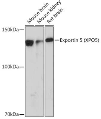 Western Blot: Exportin-5 Antibody (3Q8E6) [NBP3-16278]