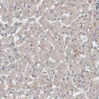 Immunohistochemistry-Paraffin: Exportin-5 Antibody [NBP1-89605]