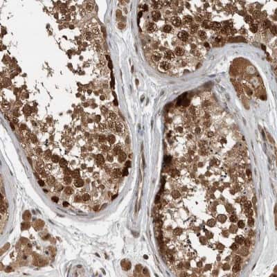Immunohistochemistry-Paraffin: Exportin-5 Antibody [NBP1-89605]