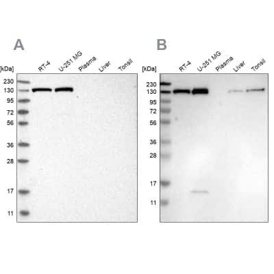 Western Blot: Exportin-5 Antibody [NBP1-89605]