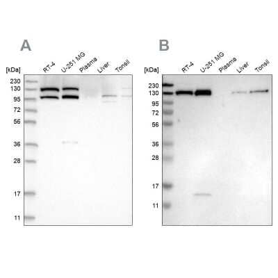 Western Blot: Exportin-5 Antibody [NBP1-89607]