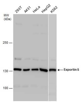 Western Blot: Exportin-5 Antibody [NBP3-12943]