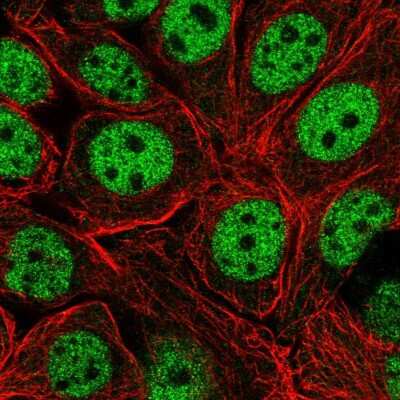 Immunocytochemistry/ Immunofluorescence: Exportin-T Antibody [NBP2-55928]