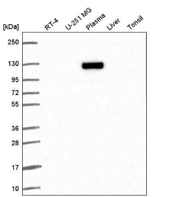 Western Blot: Exportin-T Antibody [NBP2-56900]