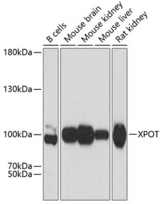 Western Blot: Exportin-T AntibodyAzide and BSA Free [NBP3-03339]