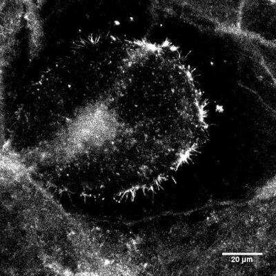 Immunocytochemistry/ Immunofluorescence: Ezrin Antibody (3C12) [NB600-1310]