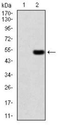 Western Blot: Ezrin Antibody (6F1A9)BSA Free [NBP2-52465]