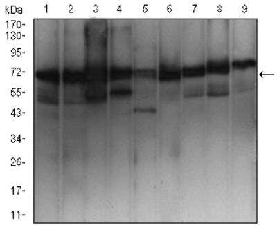 Western Blot: Ezrin Antibody (6F1A9)BSA Free [NBP2-52465]