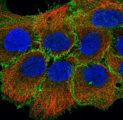 Immunocytochemistry/ Immunofluorescence: Ezrin Antibody (CL2360) [NBP2-36761]