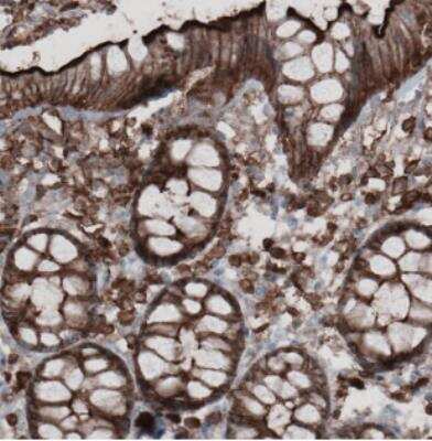Immunohistochemistry: Ezrin Antibody (CL2360) [NBP2-36761]