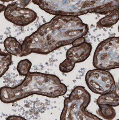 Immunohistochemistry: Ezrin Antibody (CL2360) [NBP2-36761]