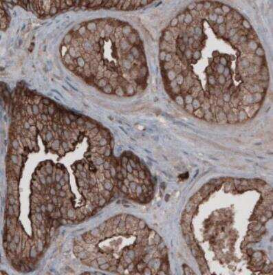 Immunohistochemistry: Ezrin Antibody (CL2360) [NBP2-36761]