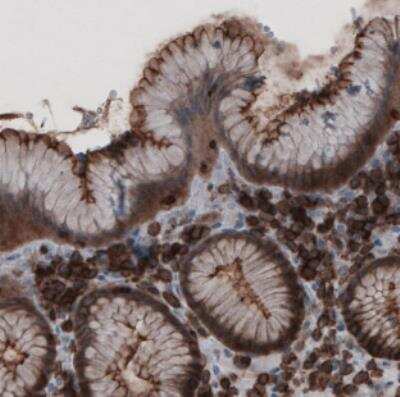 Immunohistochemistry: Ezrin Antibody (CL2360) [NBP2-36761]