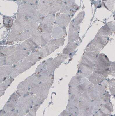 Immunohistochemistry: Ezrin Antibody (CL2360) [NBP2-36761]