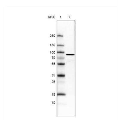 Western Blot: Ezrin Antibody (CL2360) [NBP2-36761]